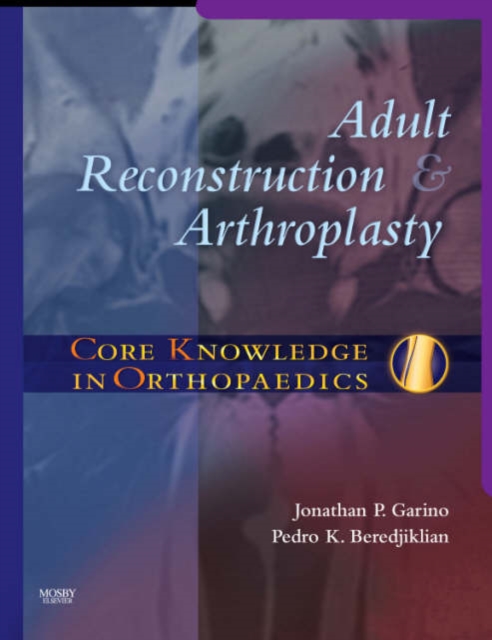 Image of Core Knowledge in Orthopaedics: Adult Reconstruction and Arthroplasty